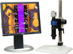 Video Microscope